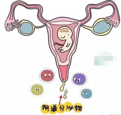 陰道分泌物午夜福利理论片在线观看的一般性狀檢查類型