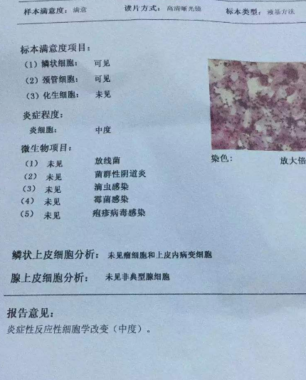 陰道分泌物午夜福利理论片在线观看廠家教你查看陰道分泌物檢測報告