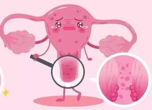 白帶常規午夜AV剧场廠家提醒女士做好私密處清洗