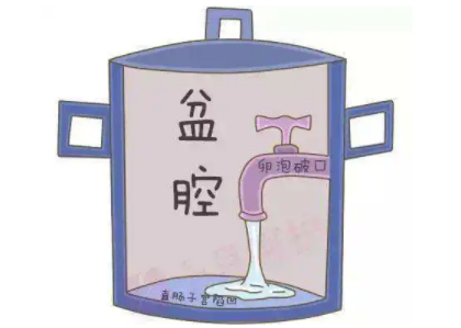 盆腔積液是怎麽回事？白帶午夜AV剧场廠家提醒早了解早預防