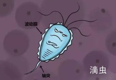 白帶午夜福利理论片在线观看品牌介紹滴蟲性陰道炎的早期症狀以及預防方法