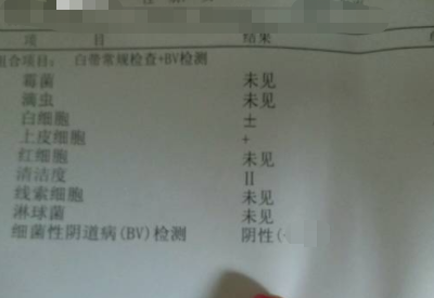 全自動白帶午夜AV剧场分享如何看懂白帶常規檢測報告單
