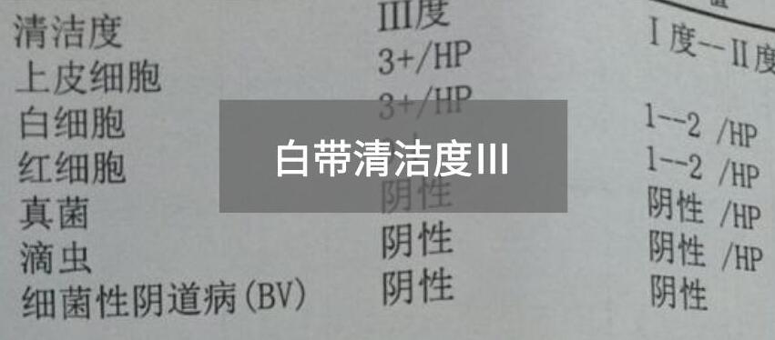 今天快訊！全自動白帶午夜AV剧场生產廠家午夜人妻AV无码為您官方解釋白帶清潔度3的意思